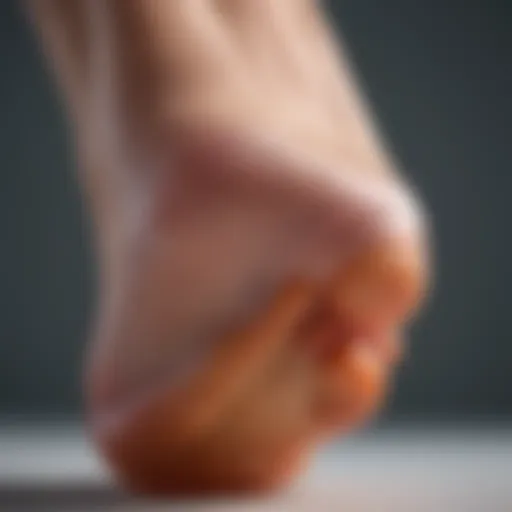 Close-up of a blister on a heel