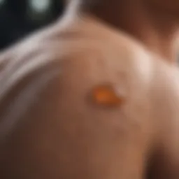 Soothing ointments for bug bites
