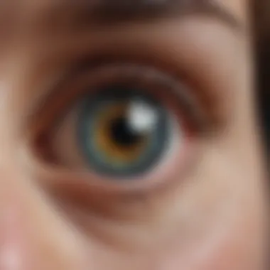 Understanding LASIK Risks Potential risks associated with LASIK eye surgery